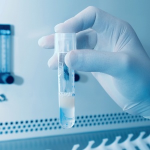 Cientistas franceses criam esperma in vitro para homens estéreis